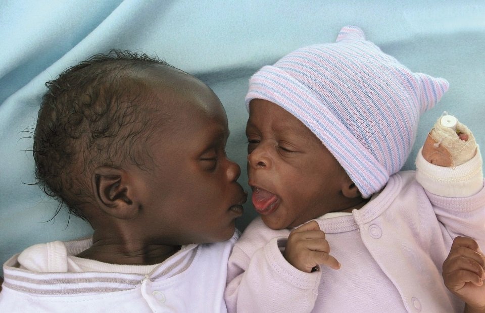 Zwei Neugeborene schauen sich an
